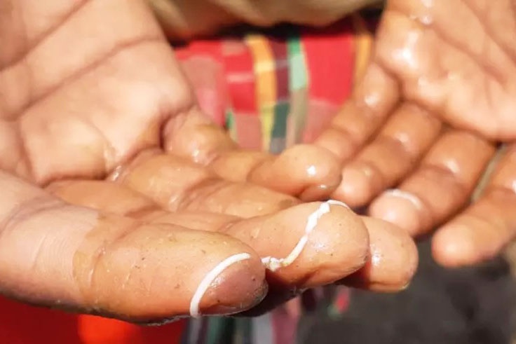 Ức chế vi khuẩn gây bệnh phân trắng ở tôm bằng Cholesterol và Phospholipids